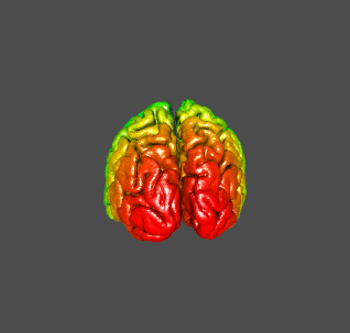 A 3 dimensional rainbow-colored rendered brain rotating in space.